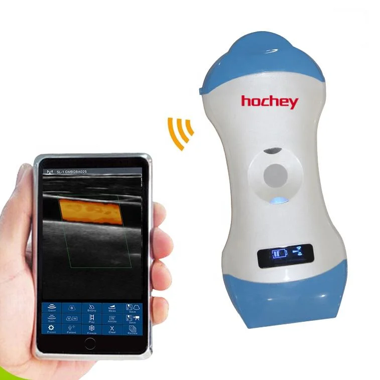 Hochey Medical Pet Mini Portable Ultrasound WiFi Scanner 128 Elements Wireless Color Doppler Ultrasound CE Approved Equipment